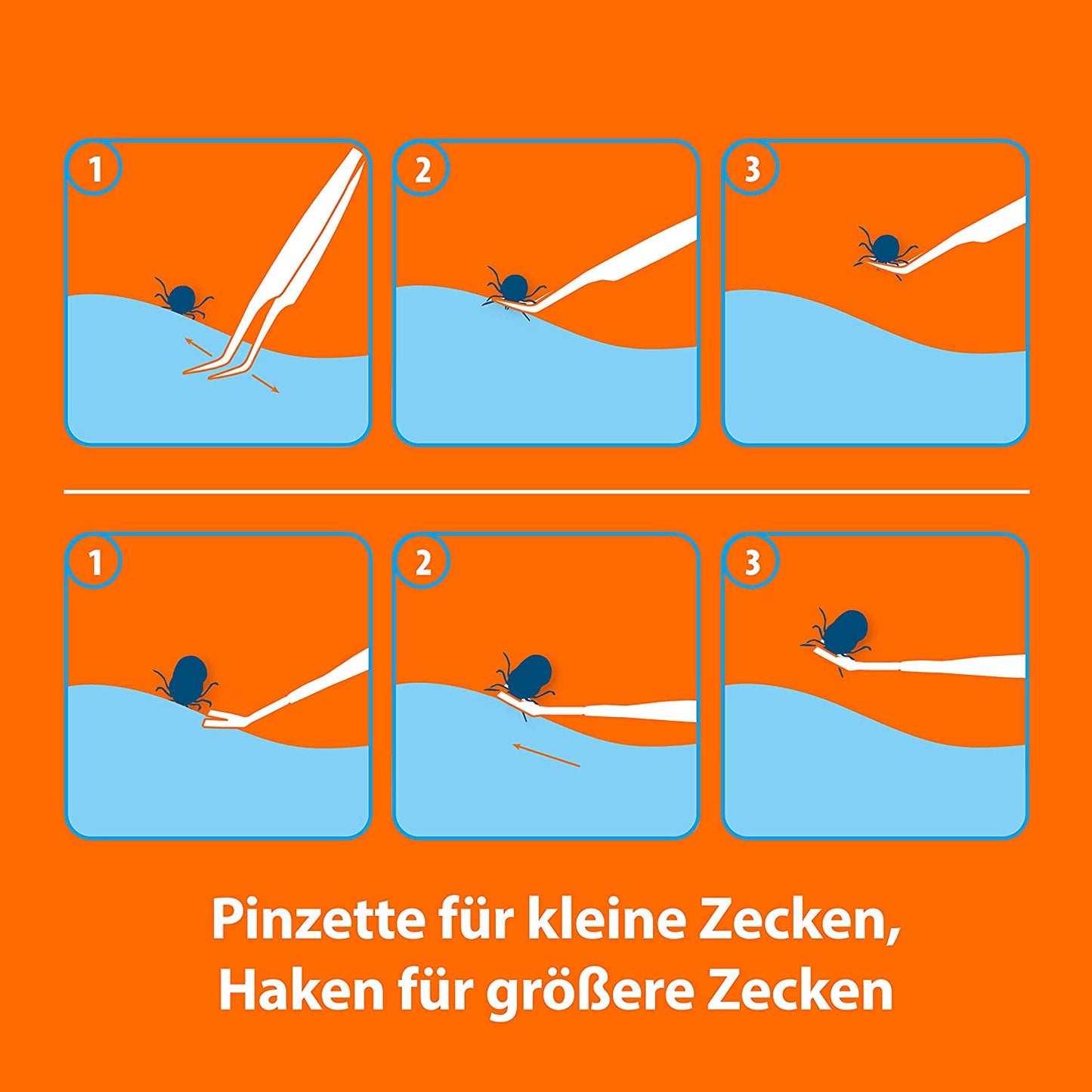 Edelstahl Zeckenhaken